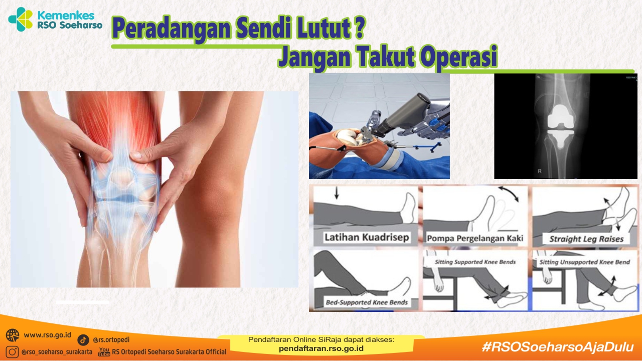 Ilustrasi lutut bunyi
