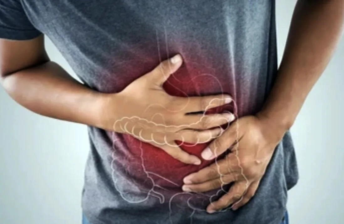 Waspada, Kasus Kanker Usus Besar 30% Terjadi di Bawah Usia 40 Tahun
