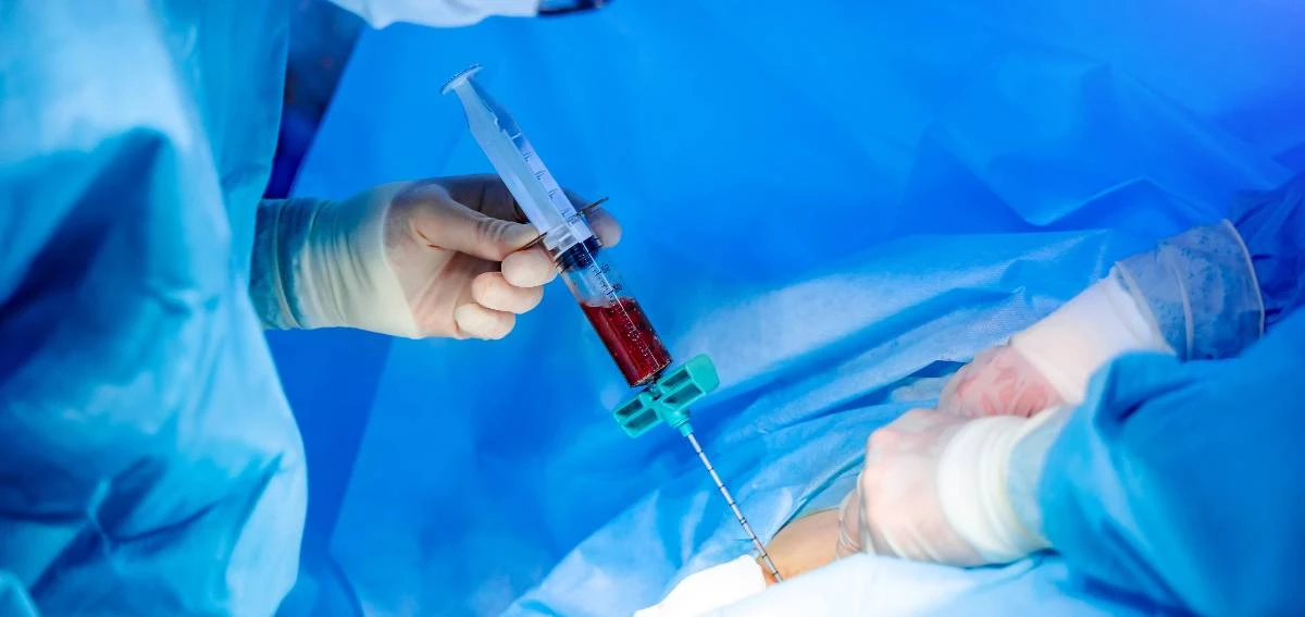 Bone Marrow Transplant