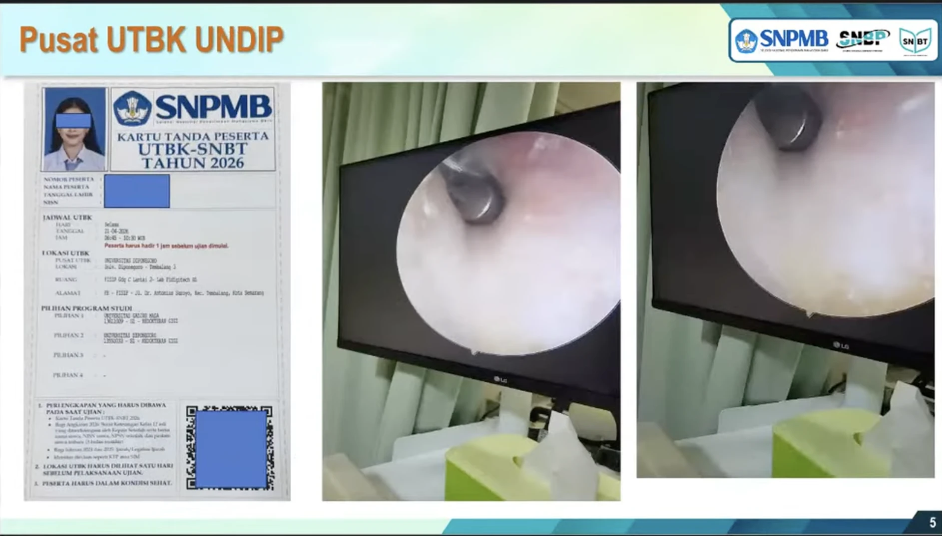 Menguak Modus Kecurangan UTBK 2026 Hari Pertama: Dari Manipulasi Foto hingga Alat THT
