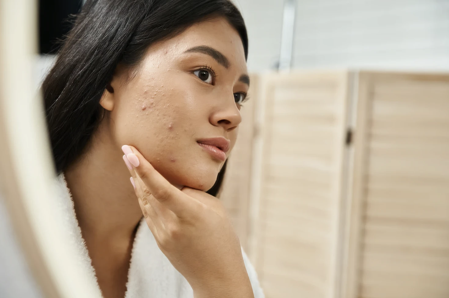 Kenali 6 Jenis Jerawat dan Cara Mengatasinya, Kapan Harus ke Dokter?